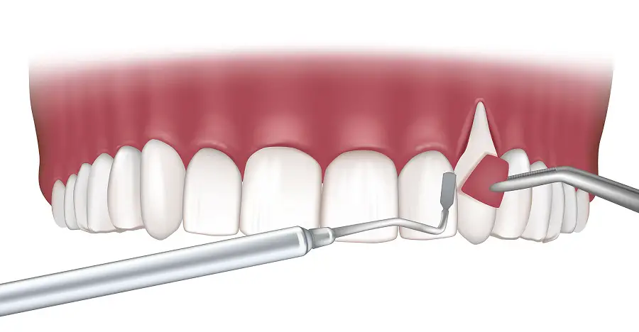 متخصص جراحی لثه