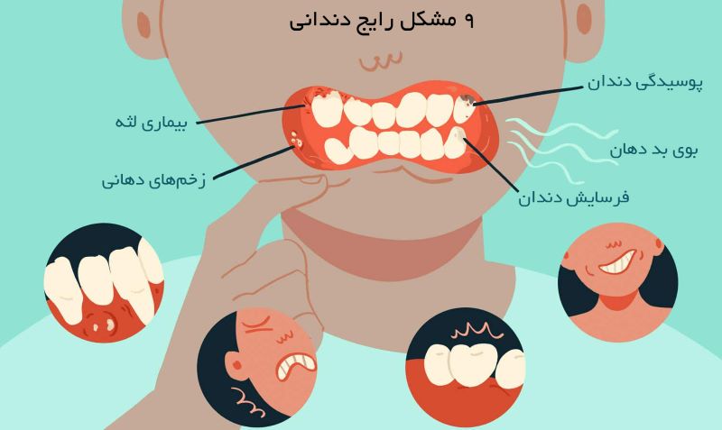 درمان بیماری های دندان در ونک دندانپزشکی دکتر دوستکی