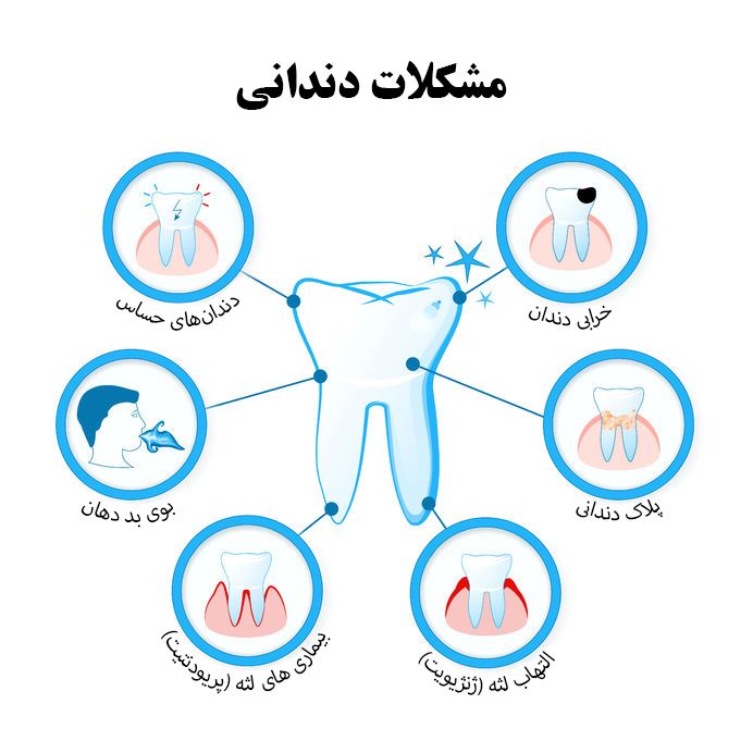 بیماری های لثه و التهاب لثه