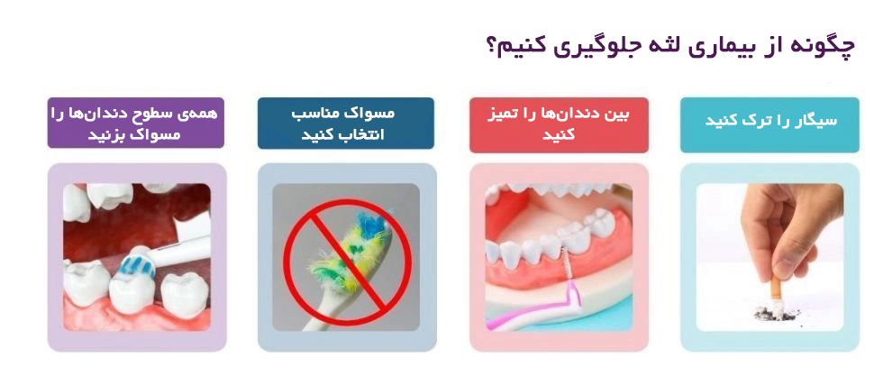 پیشگیری از بیماری های لثه