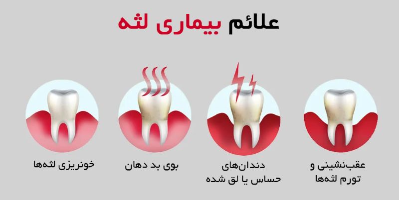 پیشگیری از بروز بیماری های لثه