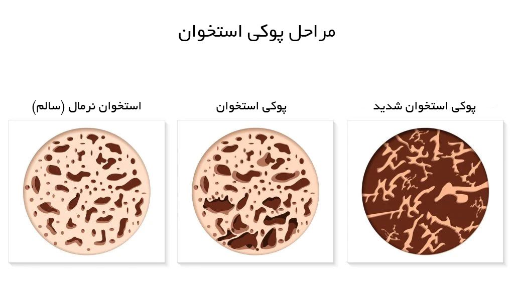 کاشت ایمپلنت دندان در ونک