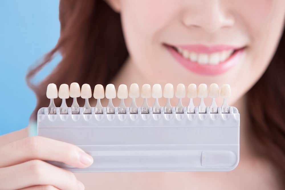 لمینت سرامیکی یا کامپوزیت؟