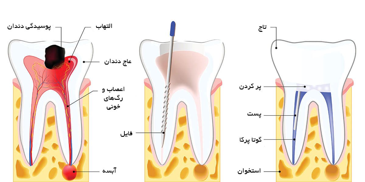 دندانپزشکی تخصصی در ونک