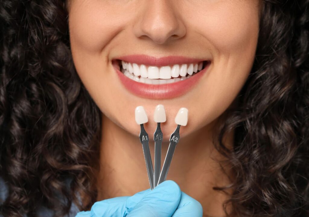 روکش دندان و زیبایی لبخند