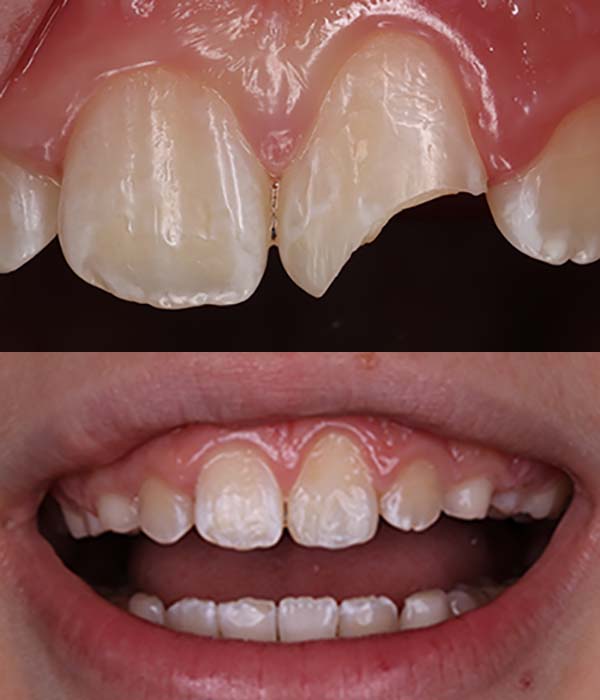 زیبایی لبخند