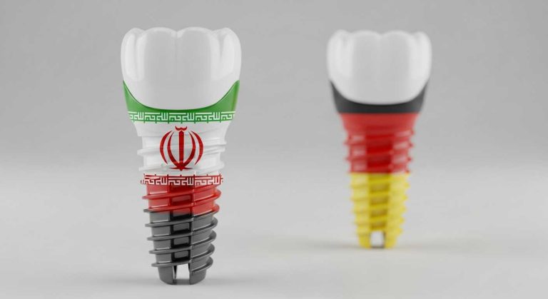 ایمپلنت های ایرانی