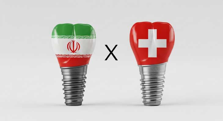 ایمپلنت های خارجی