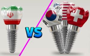 تفاوت ایمپلنت های ایرانی و خارجی