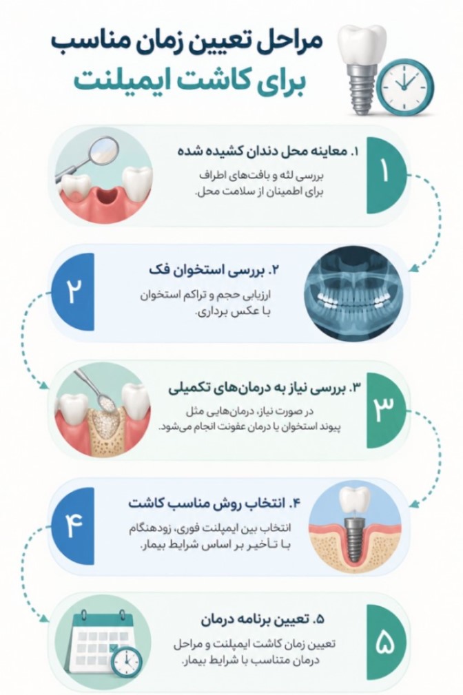 فاصله بین کشیدن دندان تا کاشت ایمپلنت چقدر باید باشد؟