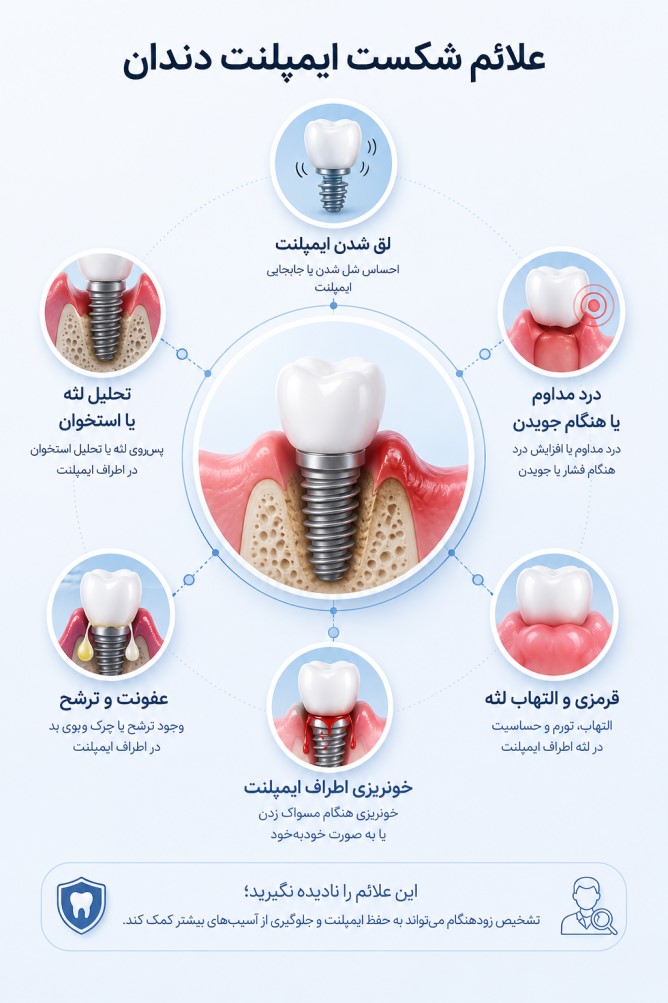 علائم شکست ایمپلنت دندان